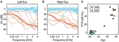 Tracking Musical Voices in Bach's The Art of the Fugue: Timbral Heterogeneity Differentially Affects Younger Normal-Hearing Listeners and Older Hearing-Aid Users